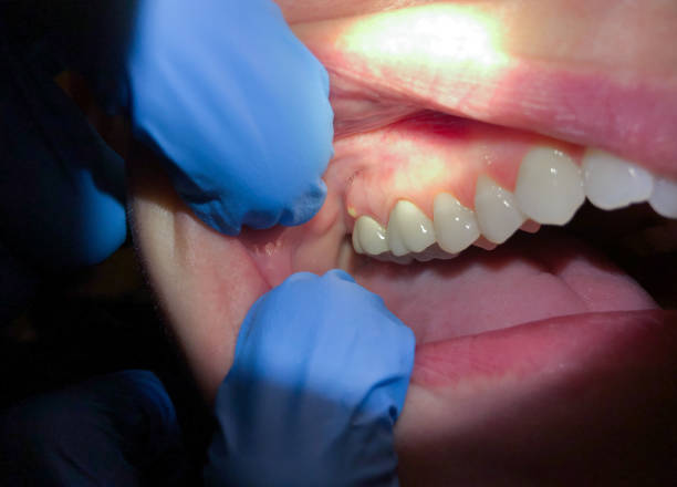 Best Mobile Emergency Dentist in Clarksburg, MD